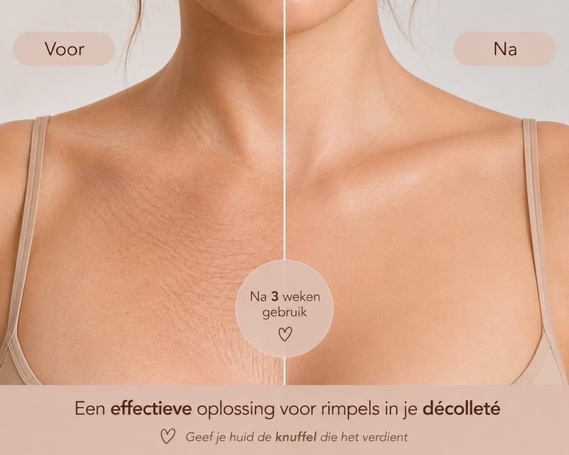 Word Wakker Zonder Slaaprimpels Op Je Décolleté